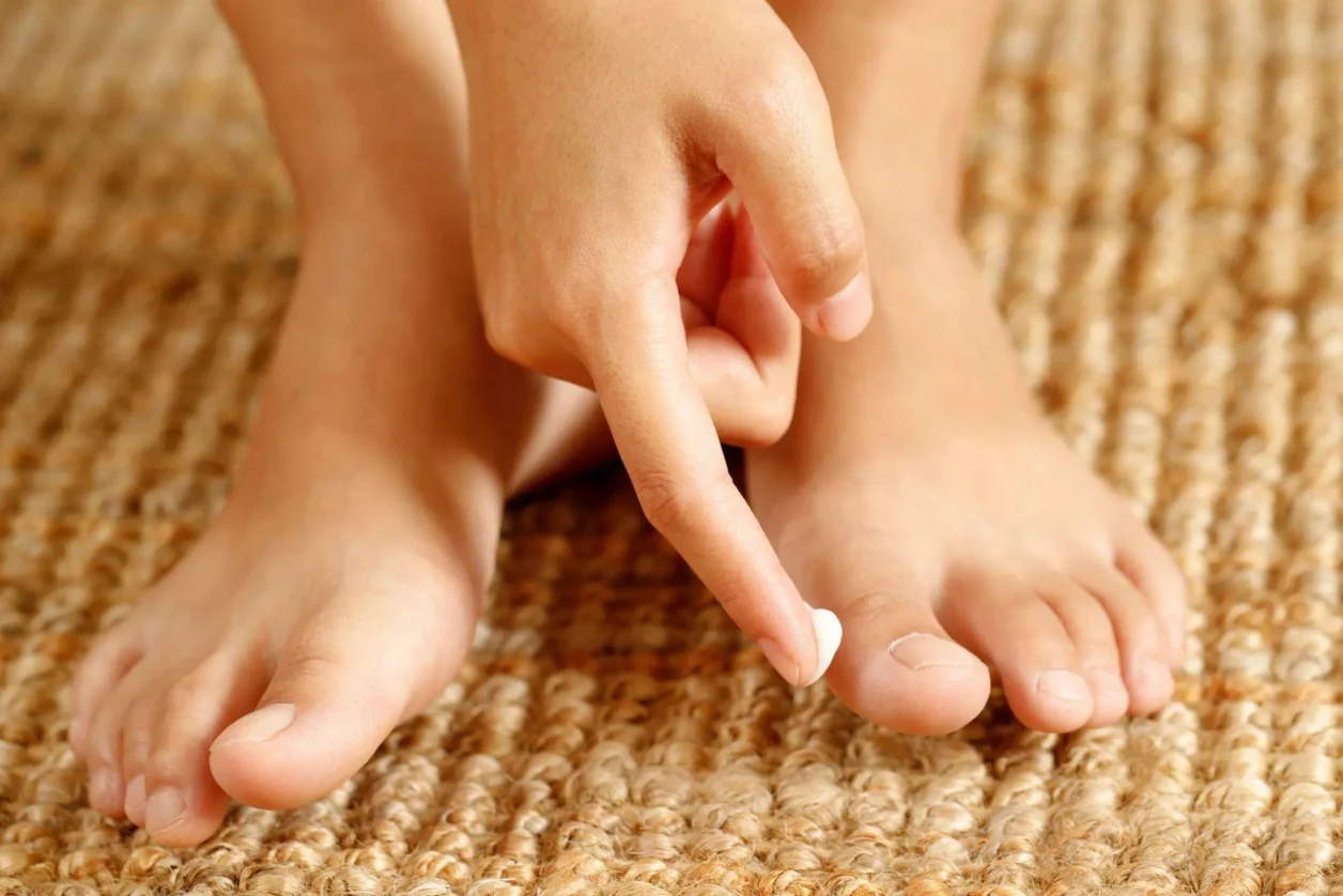 Grzybica paznokci stóp - czym jest i jak wygląda?